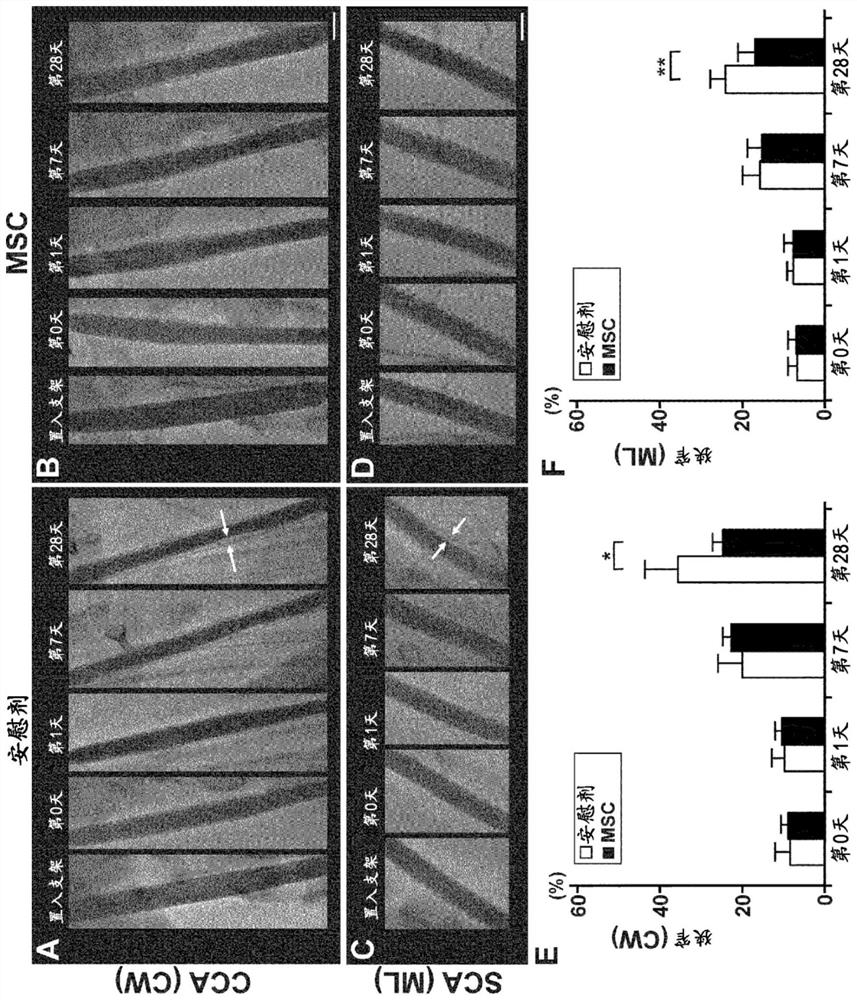 Pharmaceutical composition for preventing in-stent restenosis