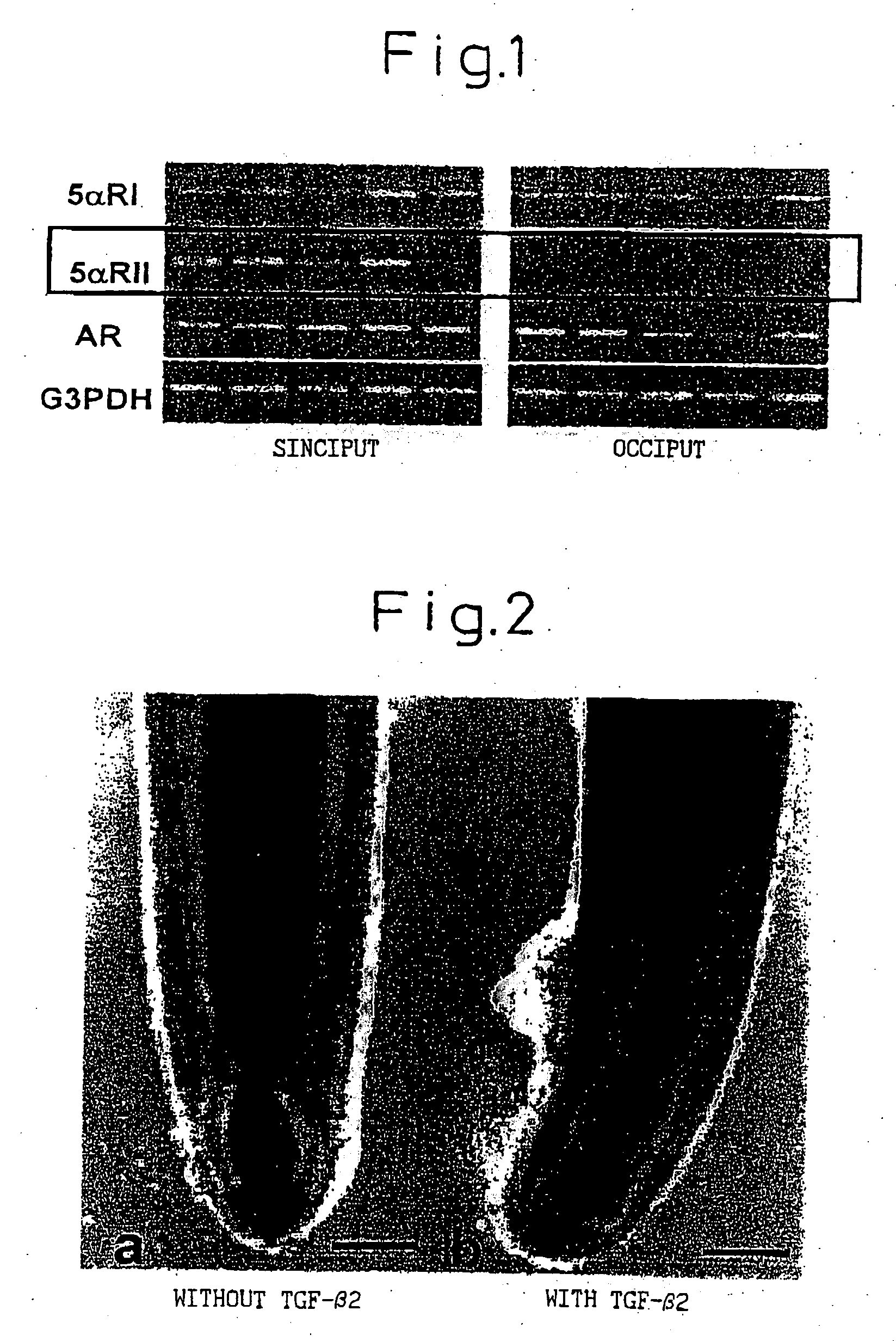 Hair tonics and method of screening the same