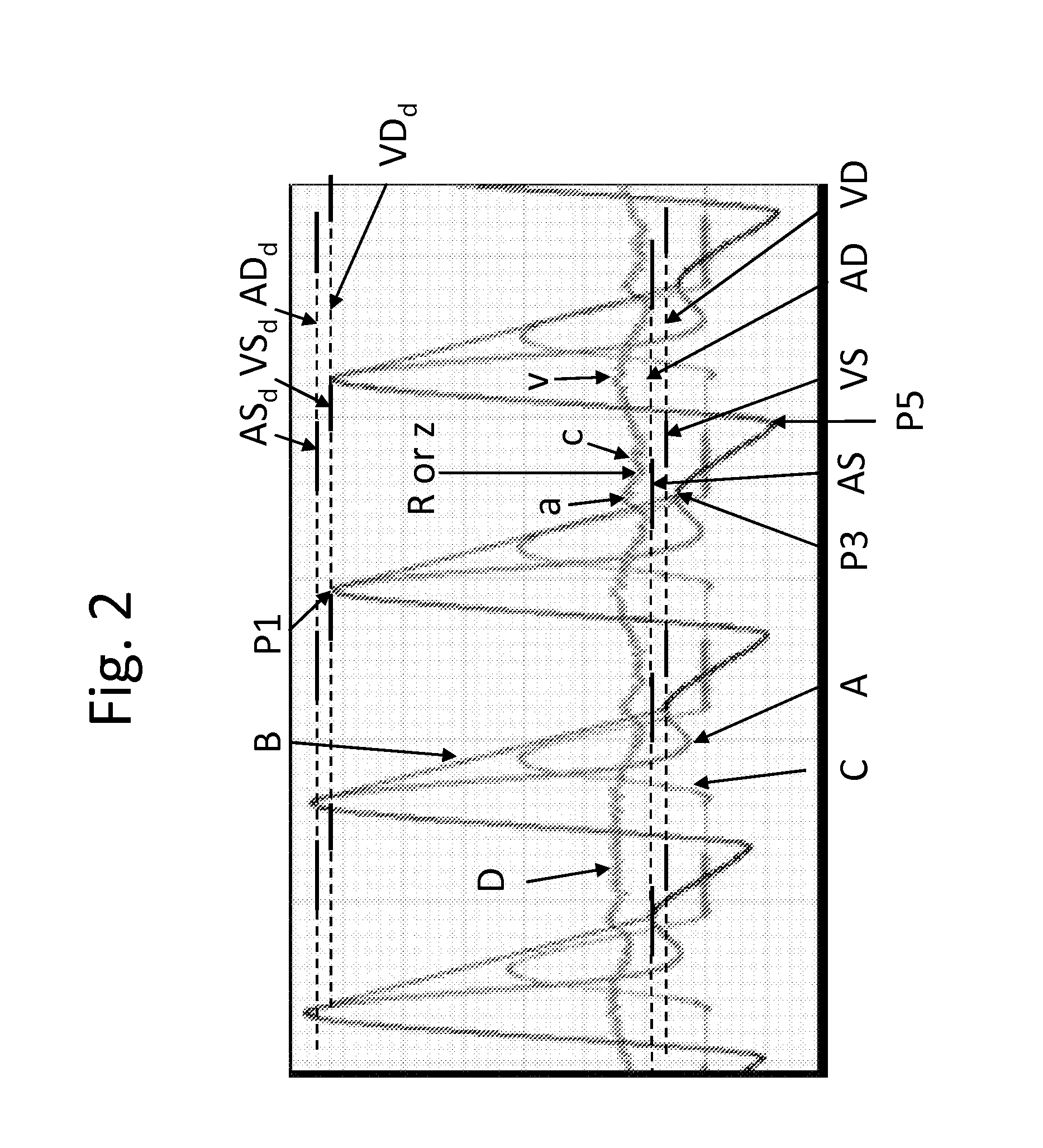 System and Method For Monitoring Cardiac Blood Flow Balance Between The Right and Left Heart Chambers