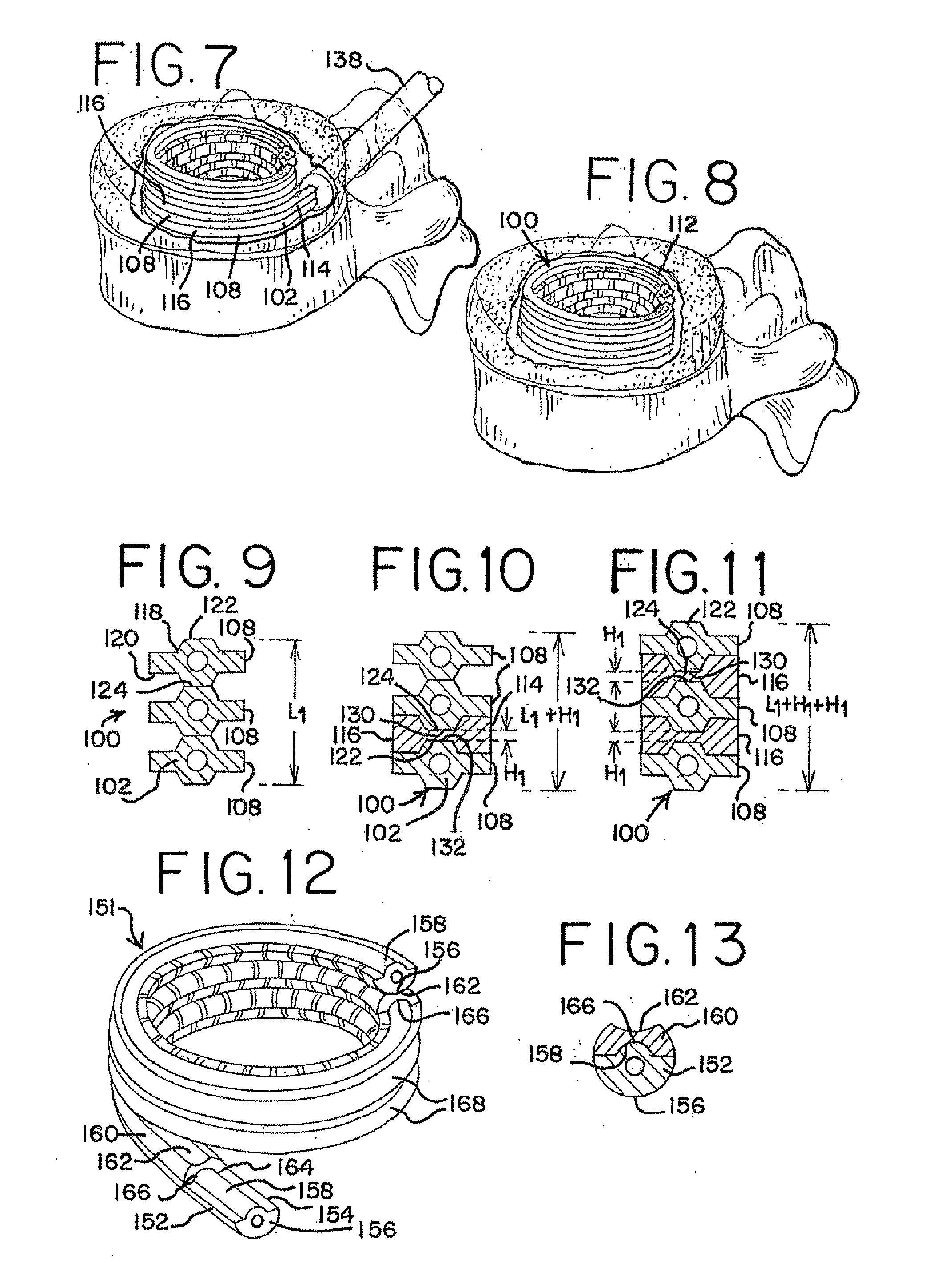 Devices for treating the spine