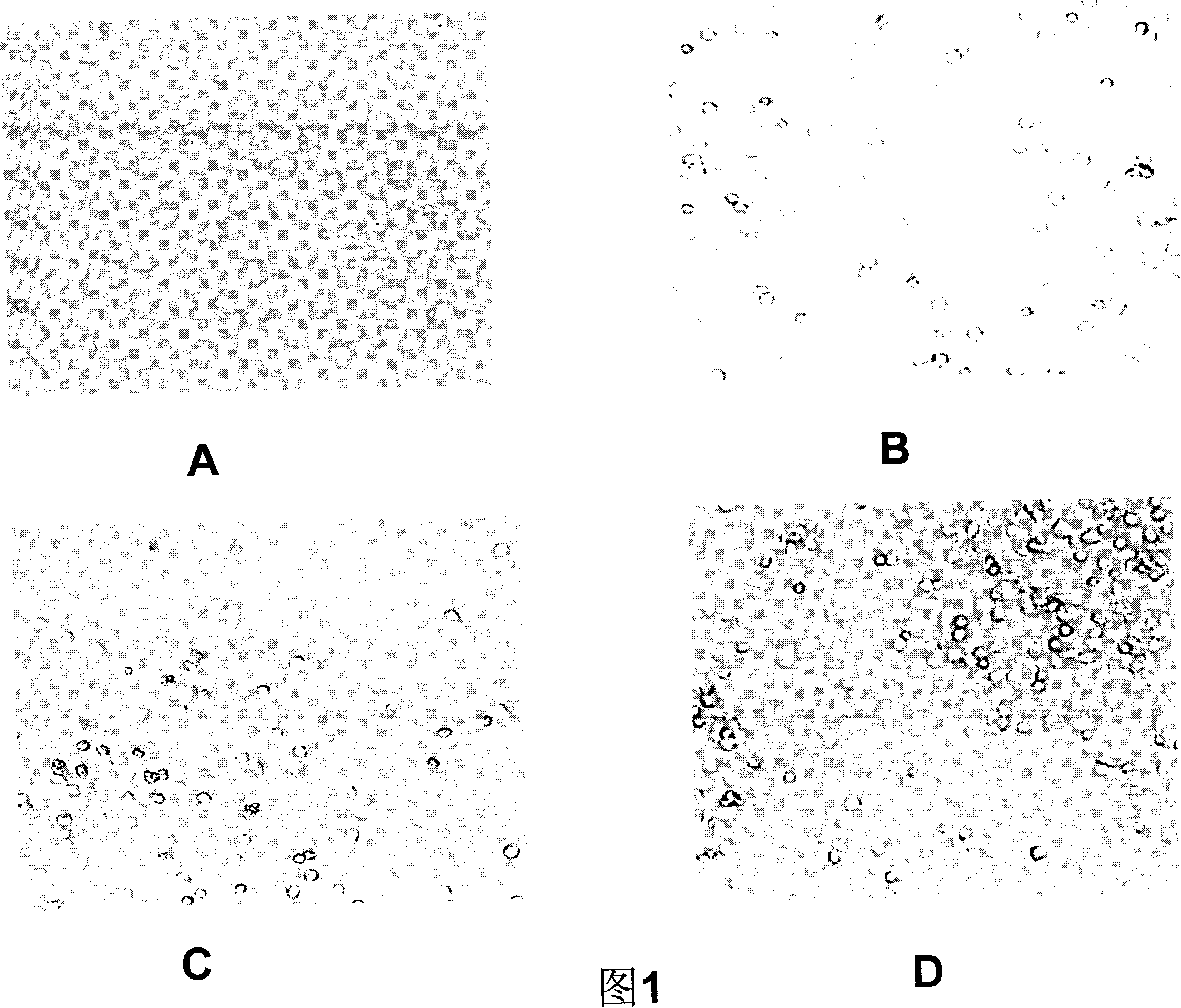 Medicine composition for treating bird flu, its preparation method and use