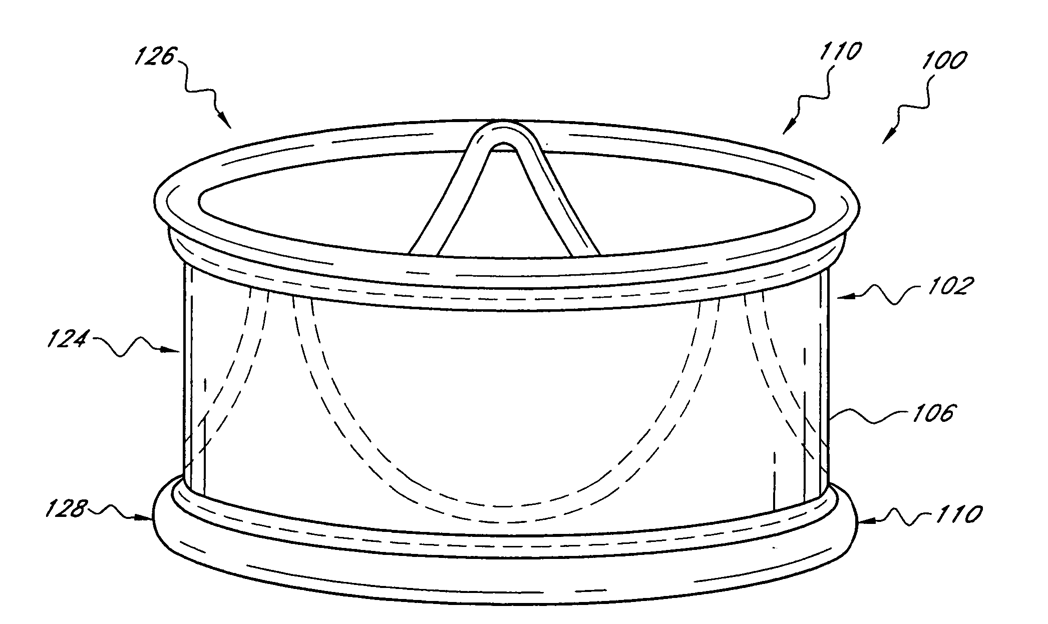 Translumenally implantable heart valve with multiple chamber formed in place support