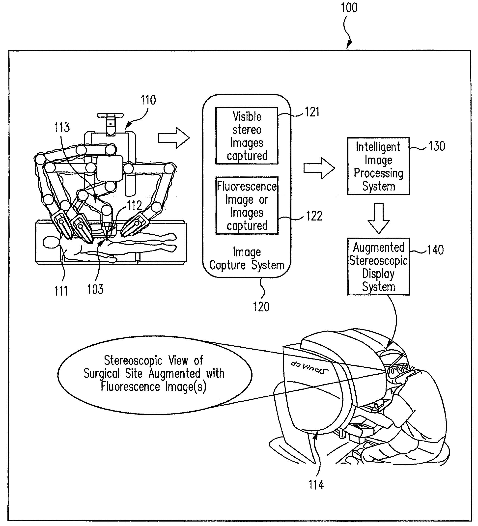 Augmented stereoscopic visualization for a surgical robot