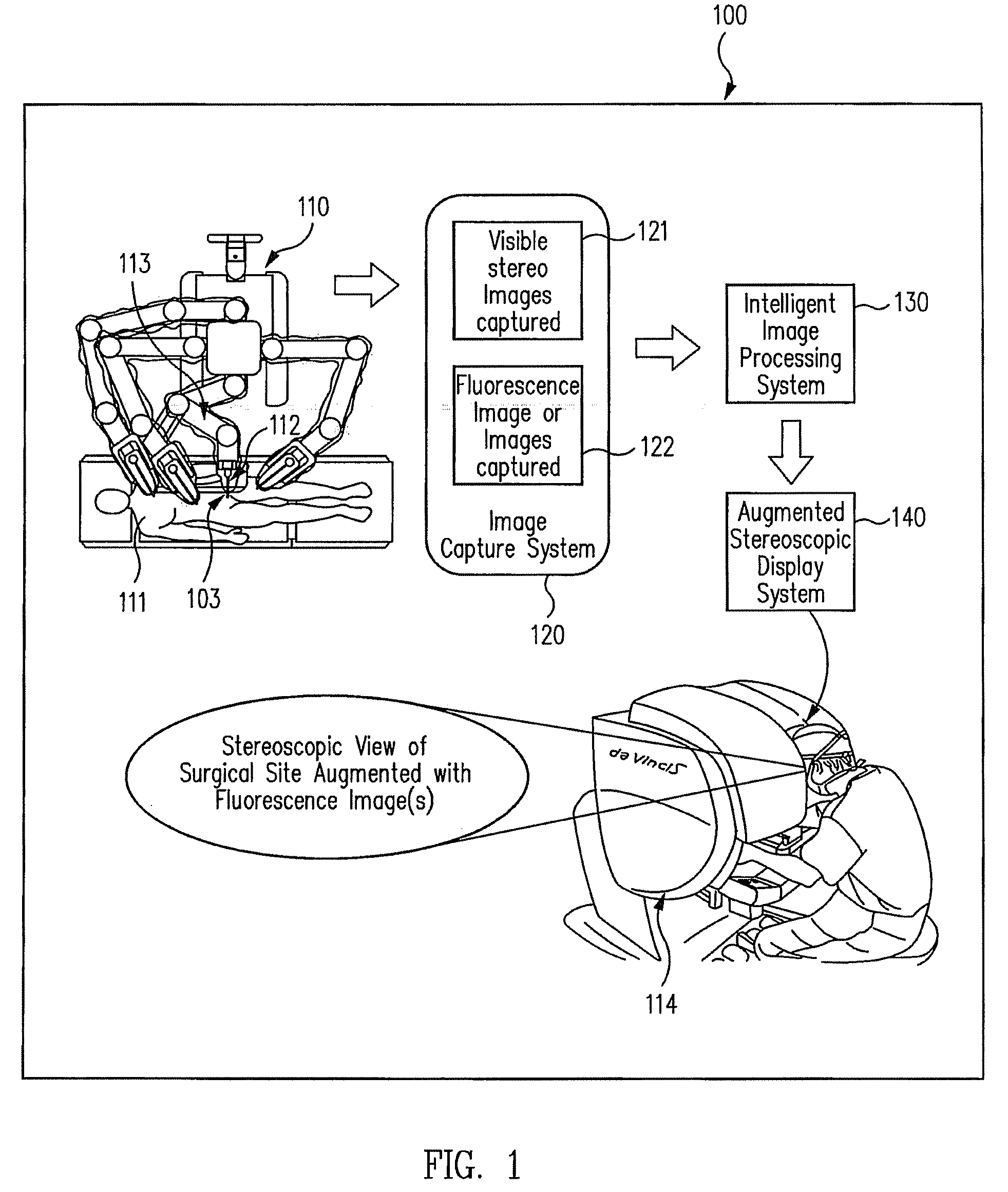 Augmented stereoscopic visualization for a surgical robot