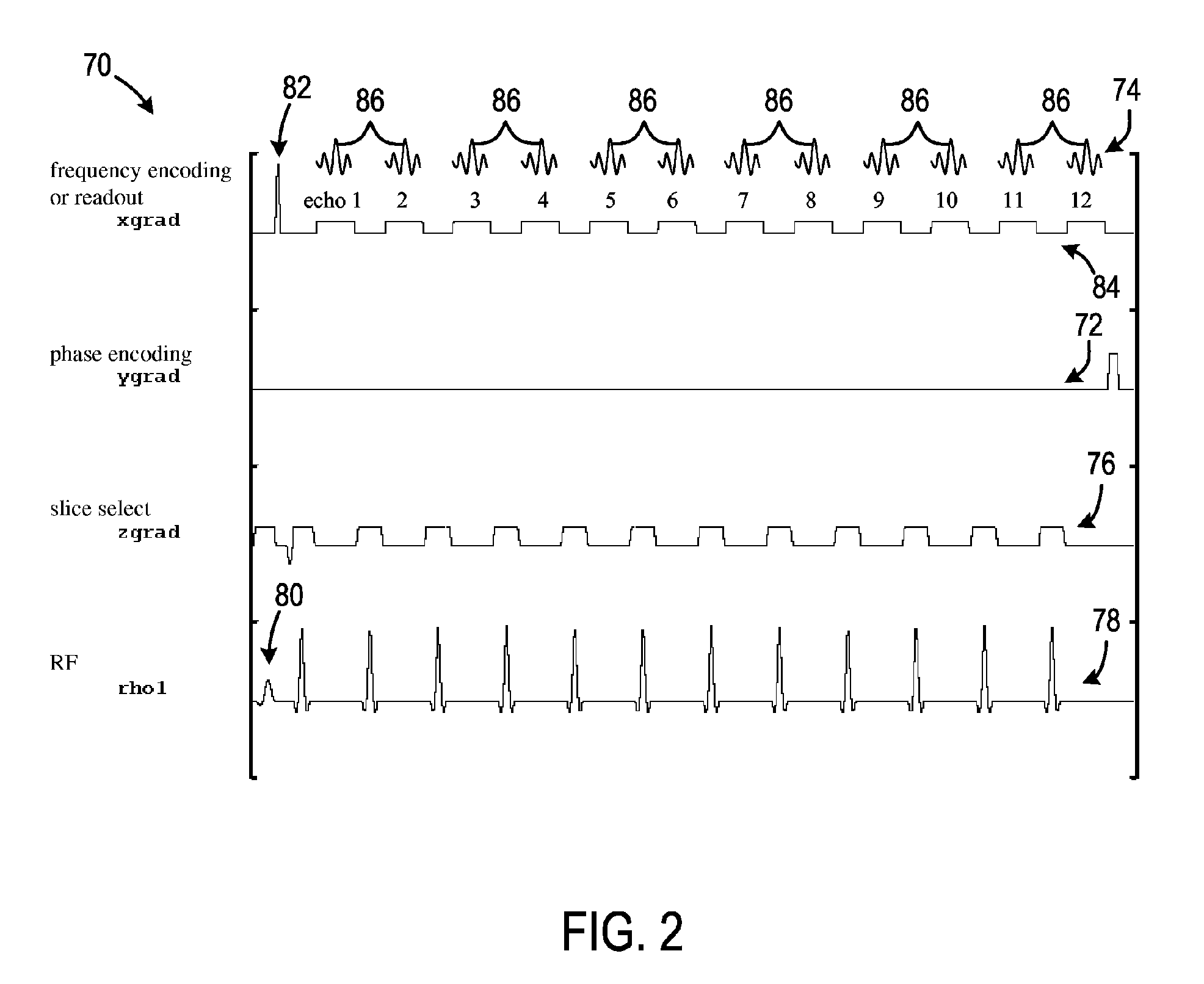 Method and apparatus for fast spin echo (FSE) prescan phase correction