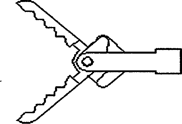 WX-shaped hard endoscopic forceps