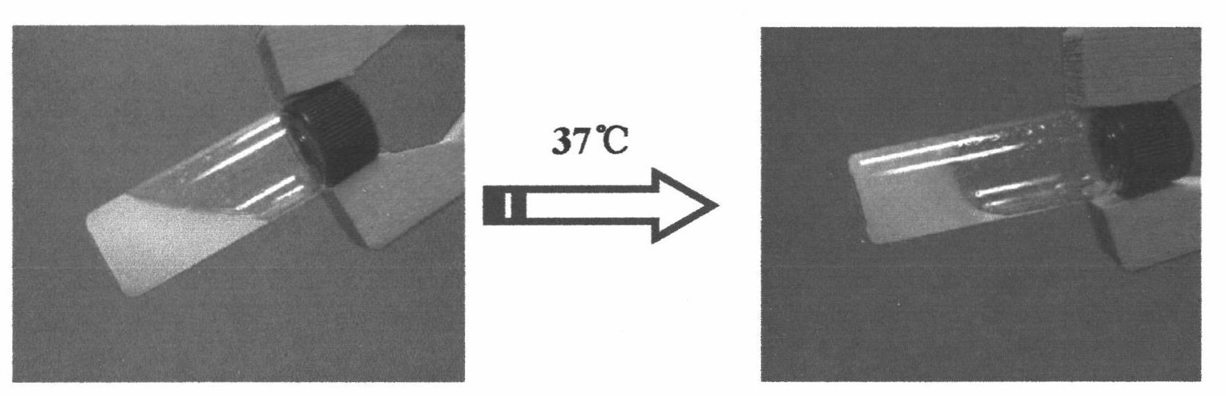 Injectable biological active factor composition and preparation method and application thereof