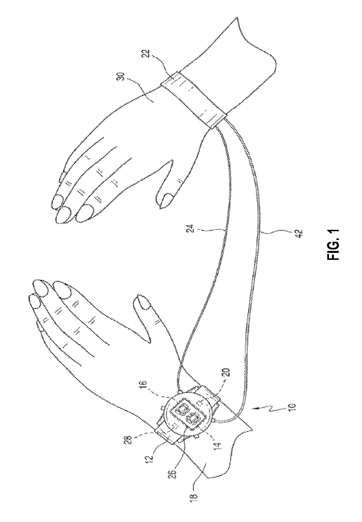 Method and apparatus for detecting atrial fibrillation