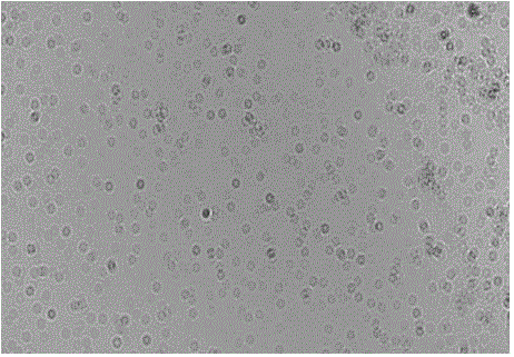 Fresh water algae rough classification and counting method based on lensless holographic imaging