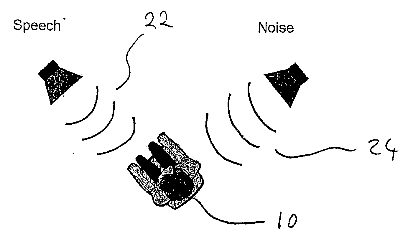 Bilateral input for auditory prosthesis