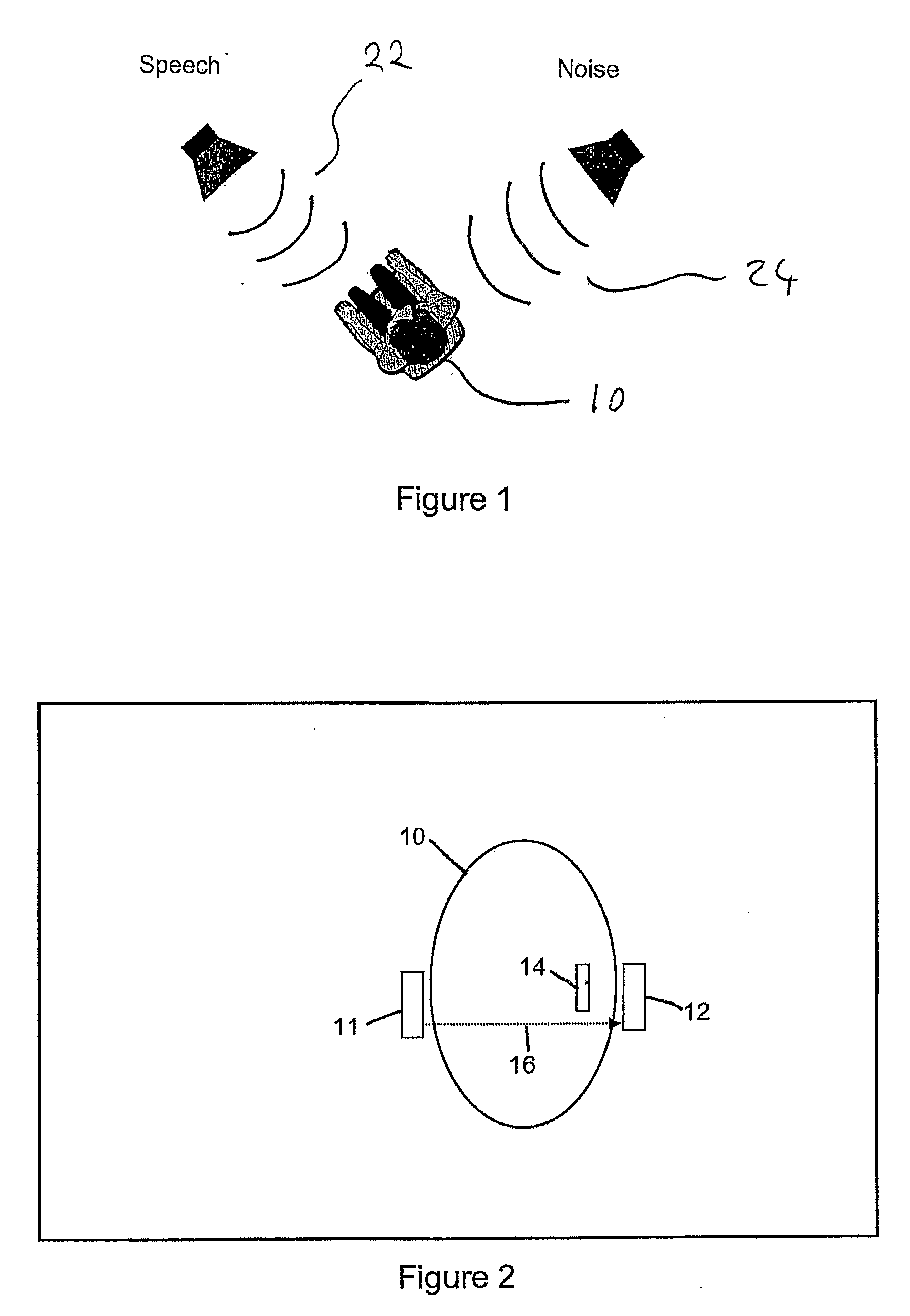 Bilateral input for auditory prosthesis