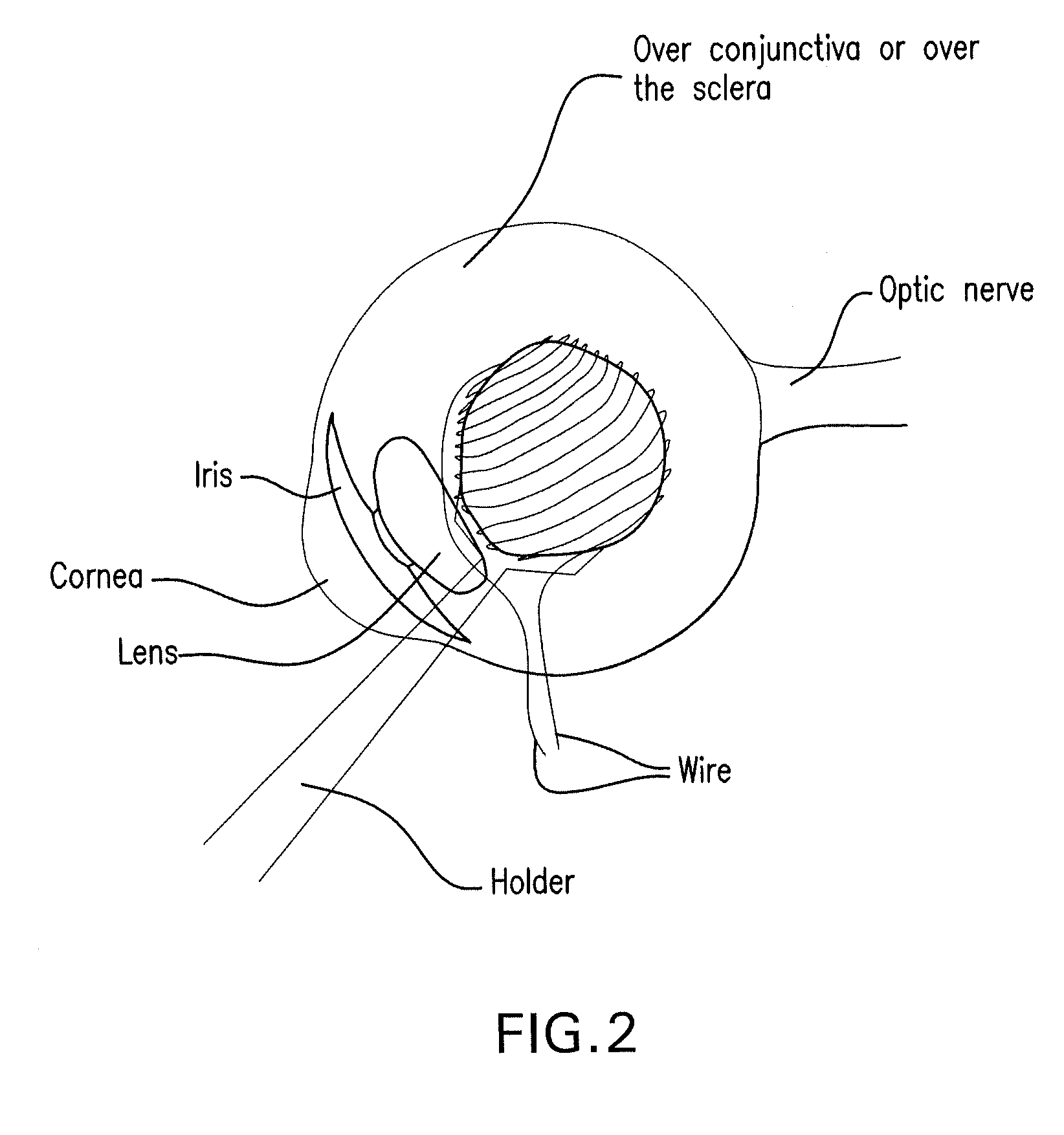 Method and composition for hyperthermally treating cells