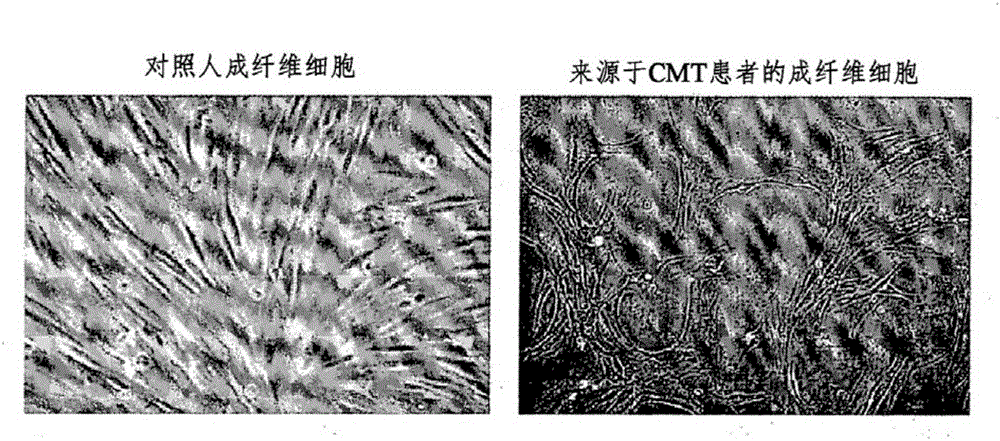 Screening method for therapeutic agents for Charcot-Marie-Tooth disease and self-differentiation motor neurons used therefor