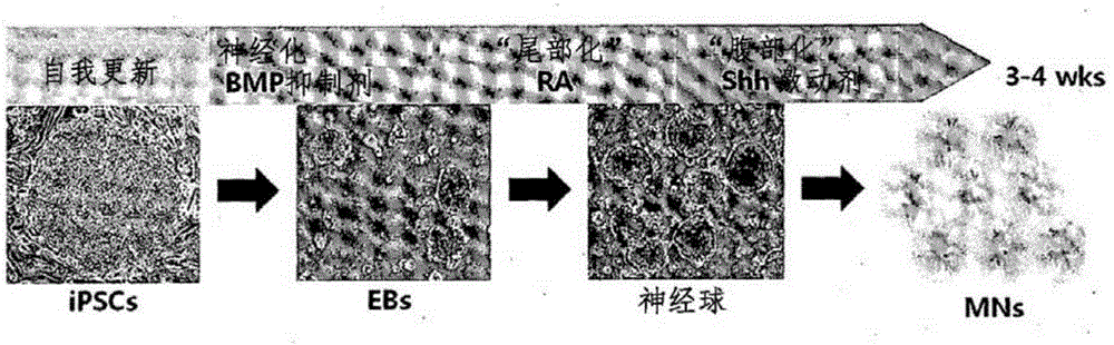 Screening method for therapeutic agents for Charcot-Marie-Tooth disease and self-differentiation motor neurons used therefor