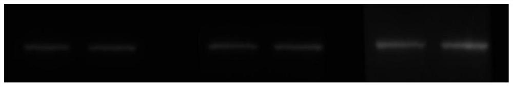 An immunochemical staining kit for cervical cancer auxiliary diagnosis