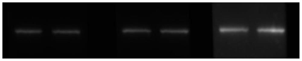 An immunochemical staining kit for cervical cancer auxiliary diagnosis