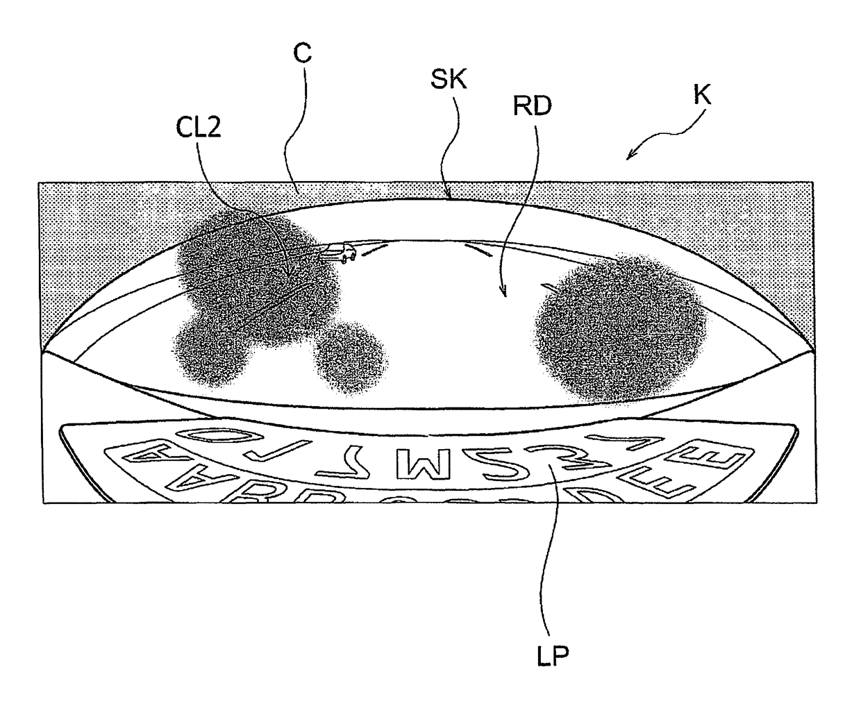 Camera device, three-dimensional object detection device, and lens cleaning method