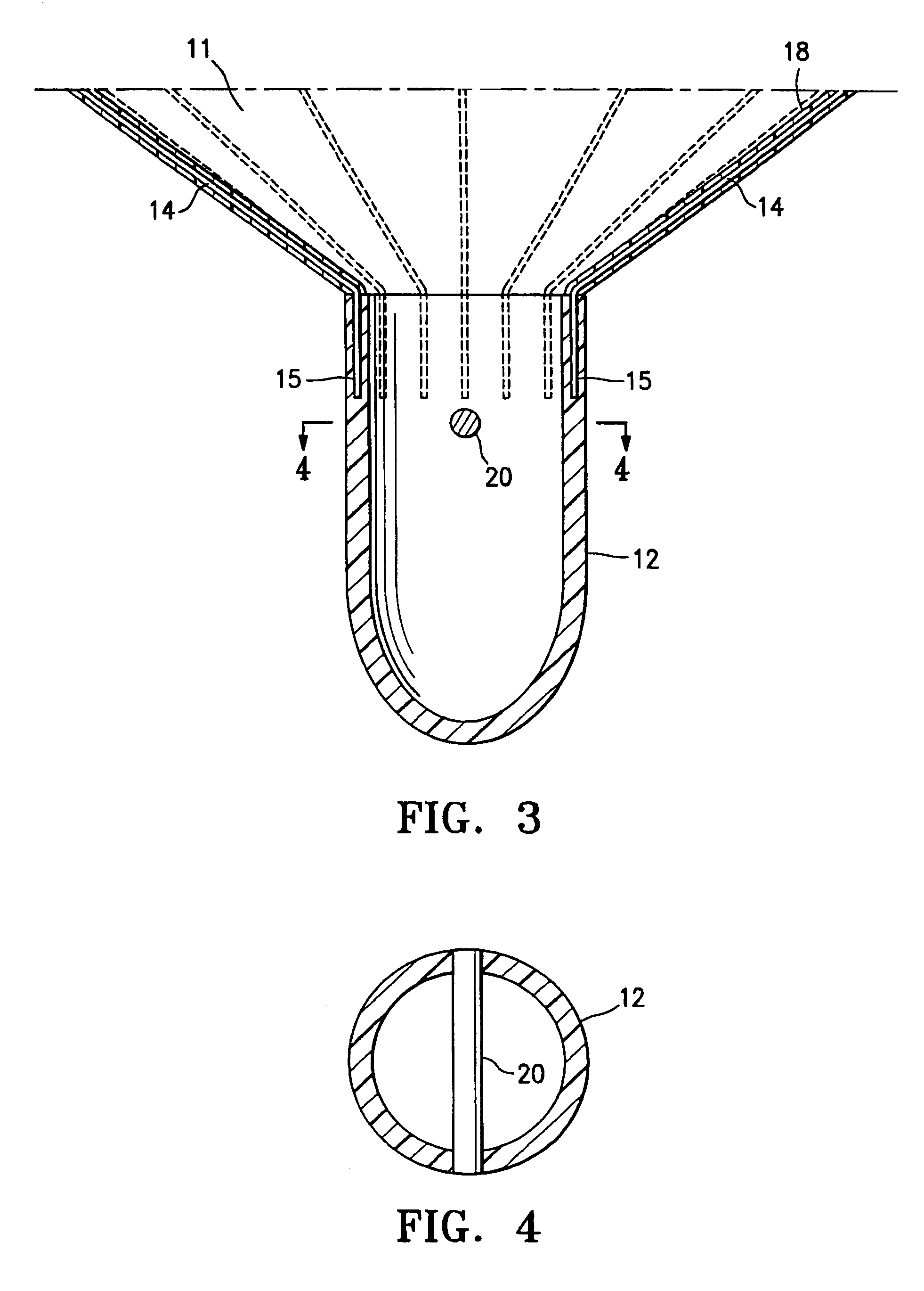 Ventricular partitioning device