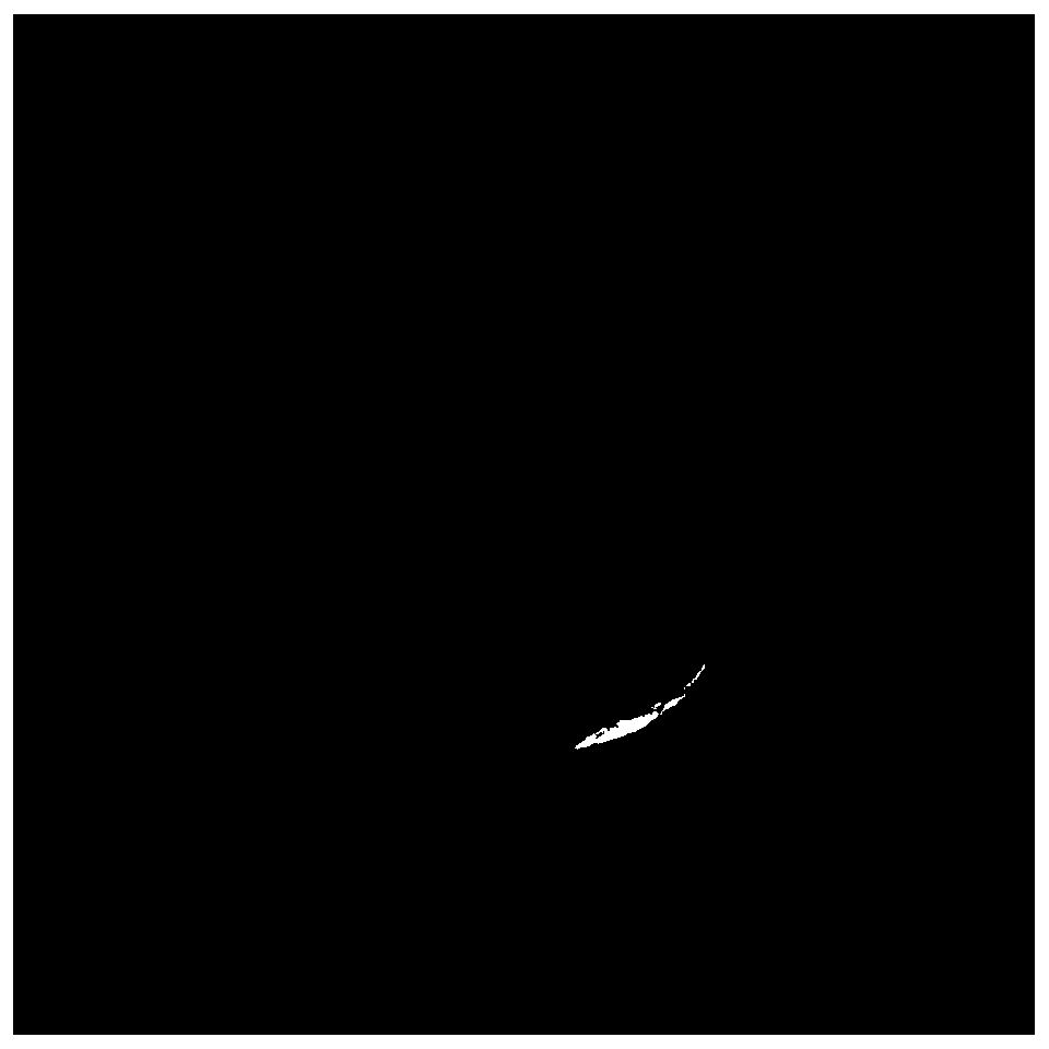 A Contour Smoothing Method Based on Freeman Chain Code in Medical Image Segmentation