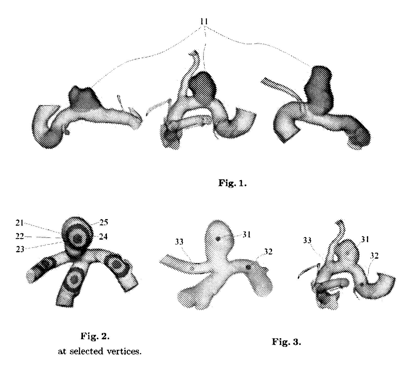 Shape Based Conditional Random Fields for Segmenting Intracranial Aneurysms