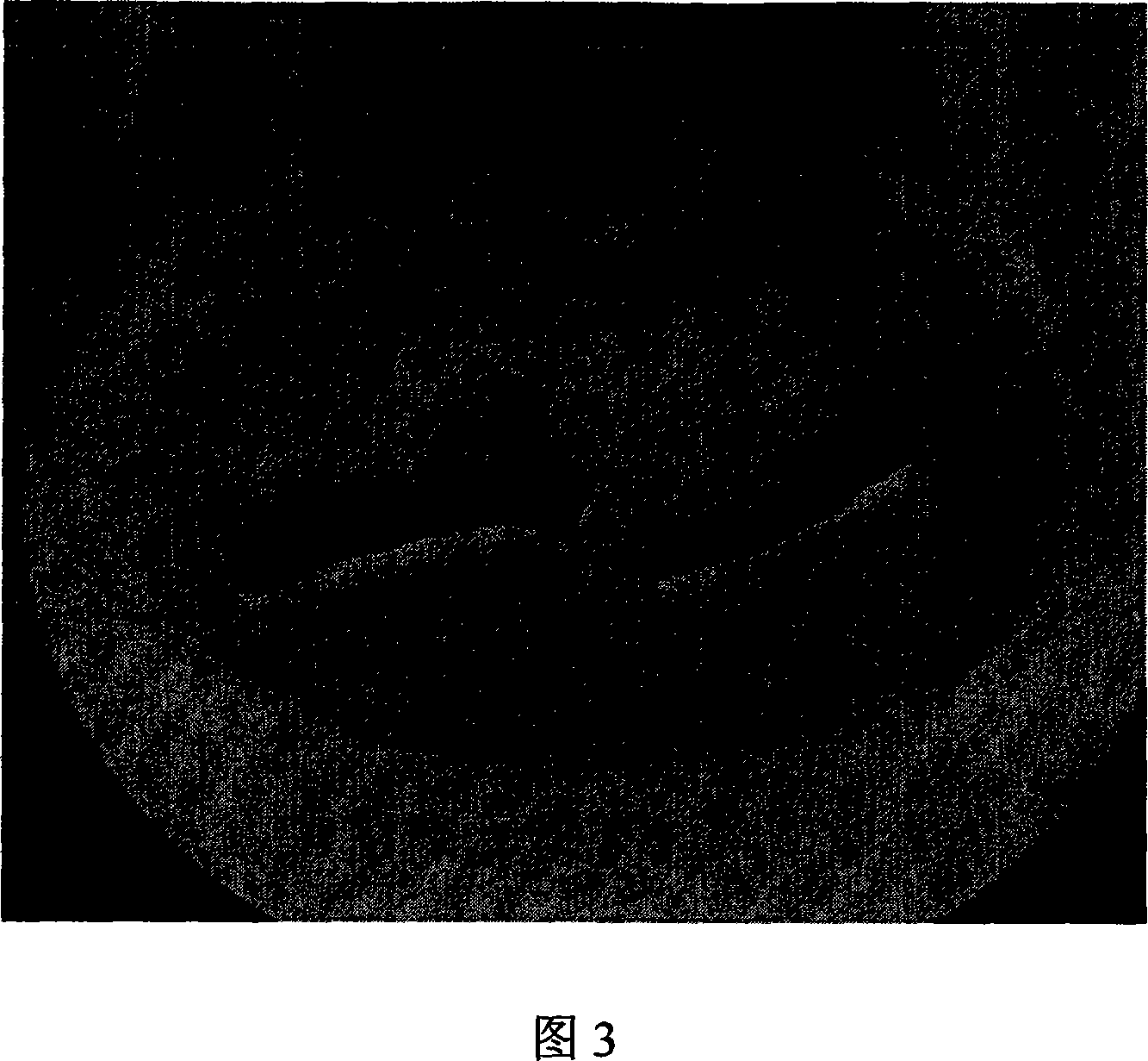 Method for high frequency plant regenerating of tallow tree tissue culture adventitious bud