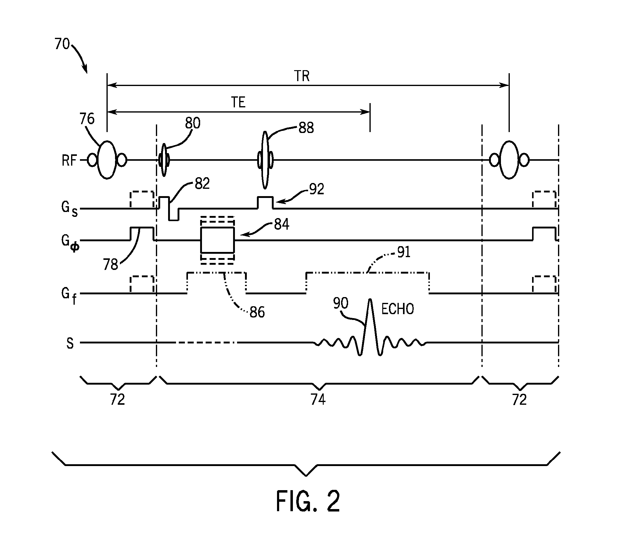 Method and apparatus for interactively setting parameters of an MR imaging sequence through inspection of frequency spectrum