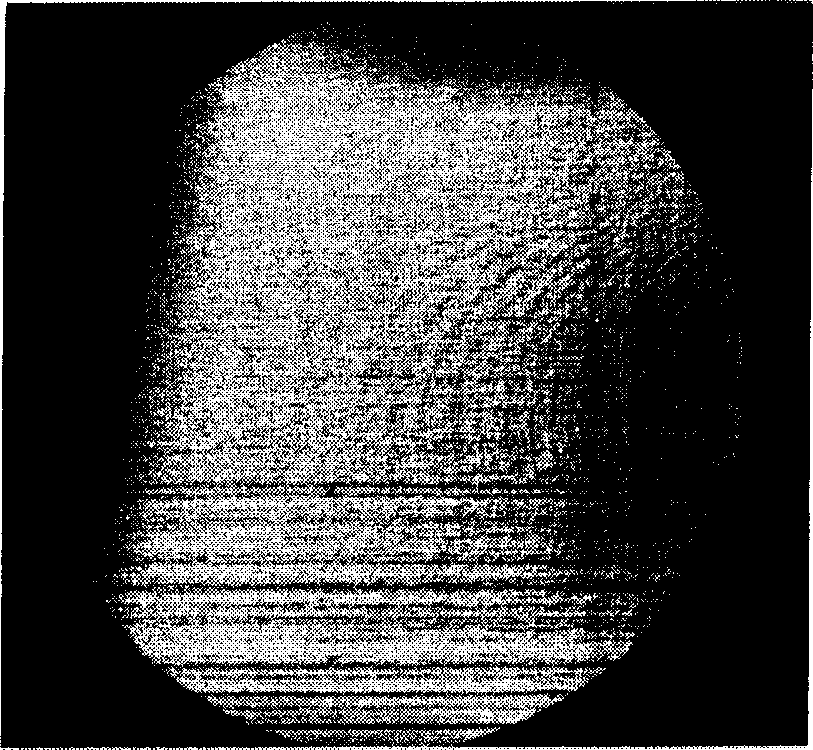 Human eyes high order optical aberration orthopraxy method