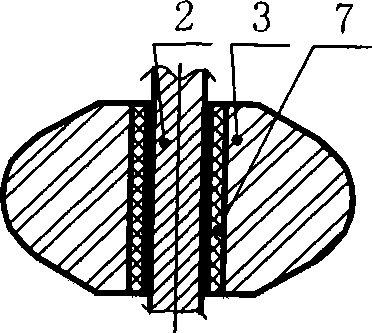 Technique abacus