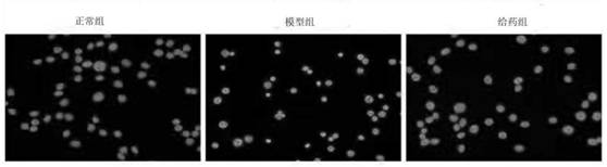 Application of oroxylum indicum as anti-oxidative stress injury agent