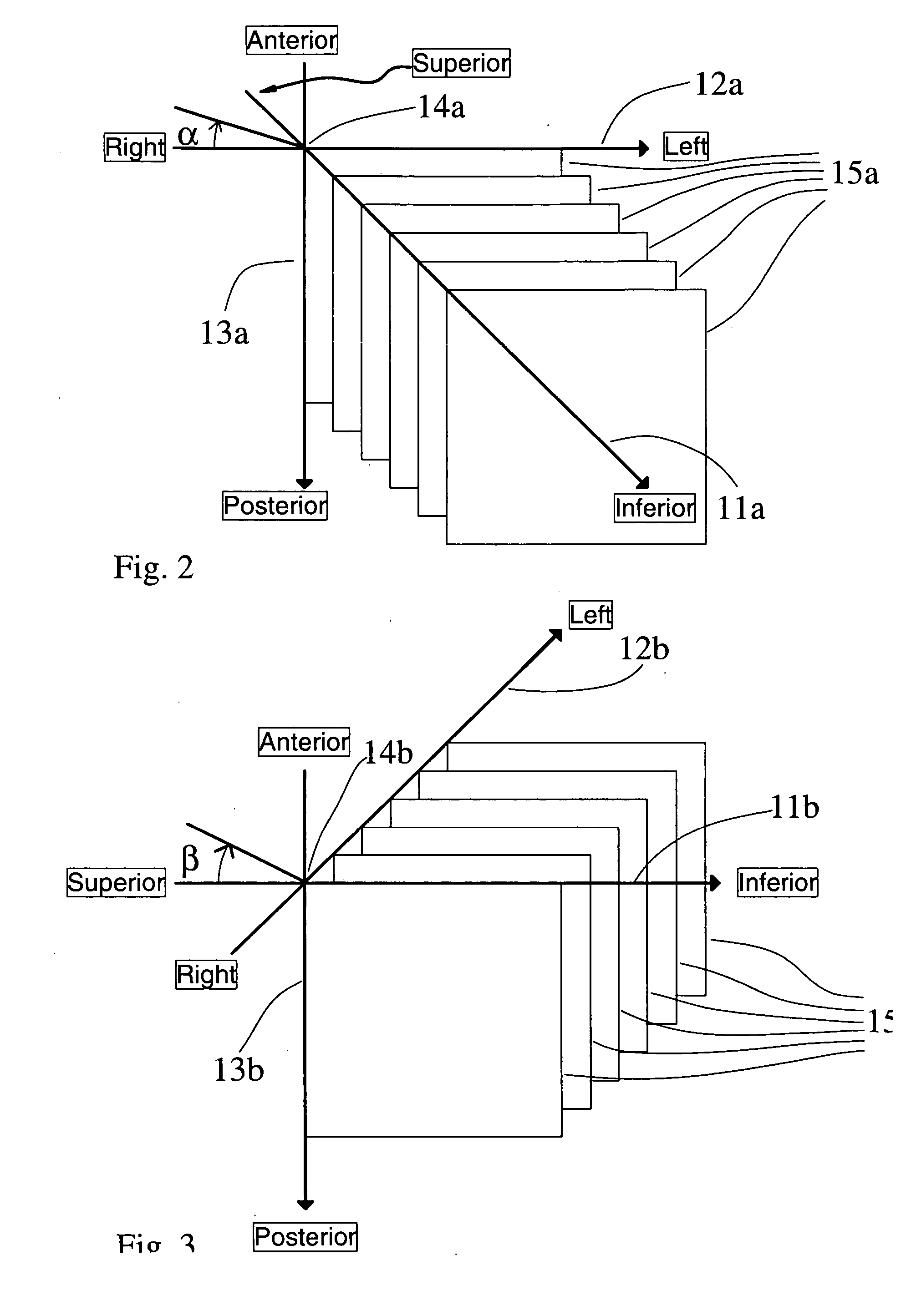 Method for assisted beam selection in radiation therapy planning