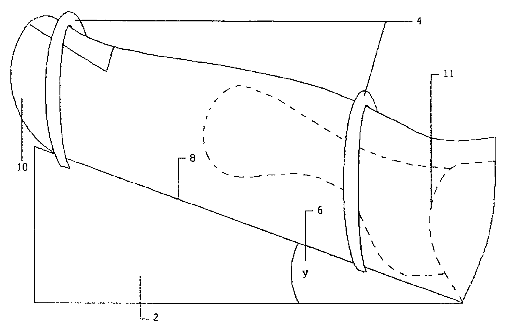 Orthopedic shoe appliance and method