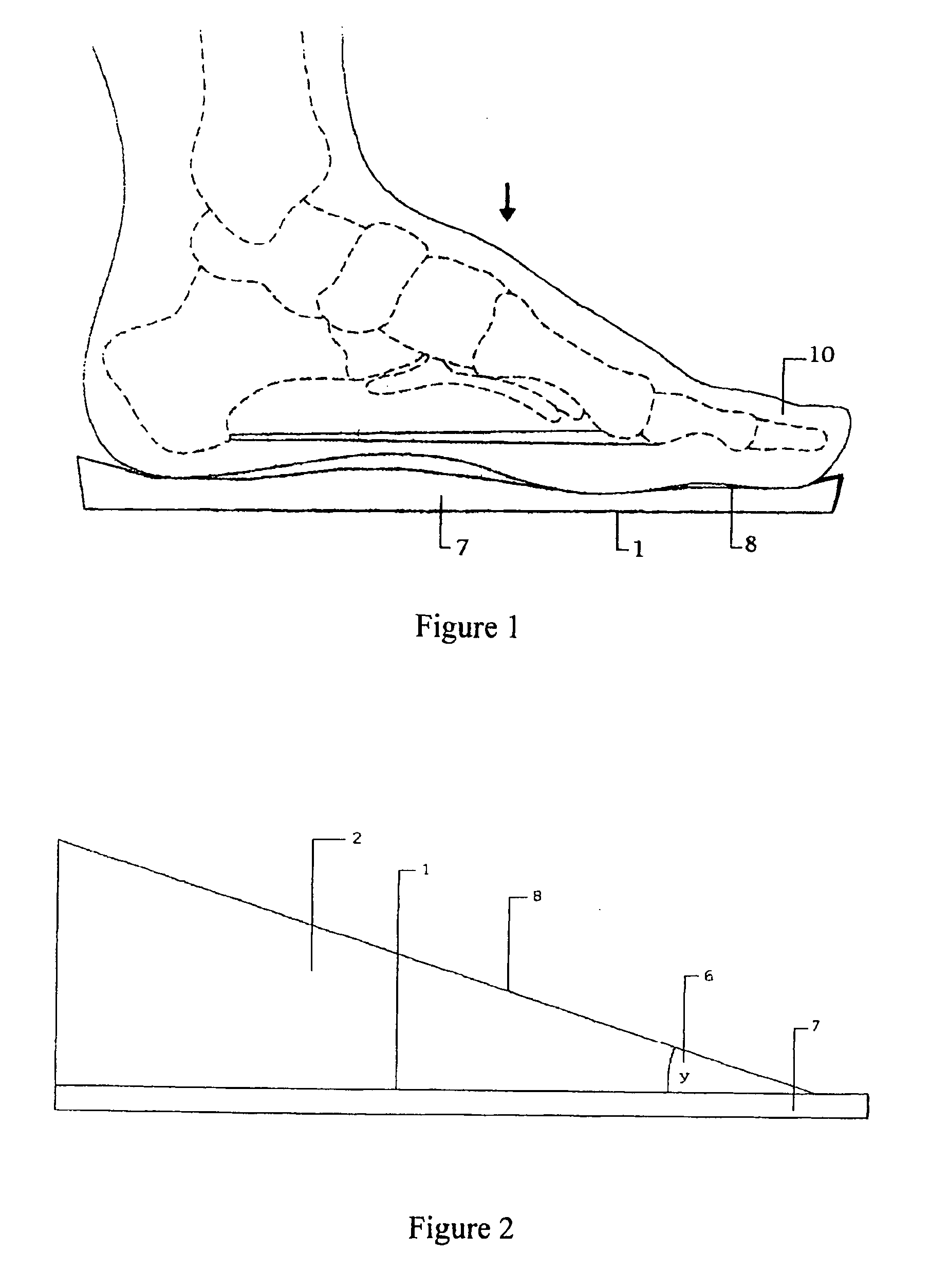 Orthopedic shoe appliance and method