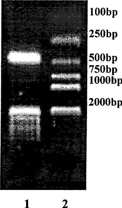 B19 virus VP1 unique region gene