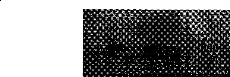 B19 virus VP1 unique region gene