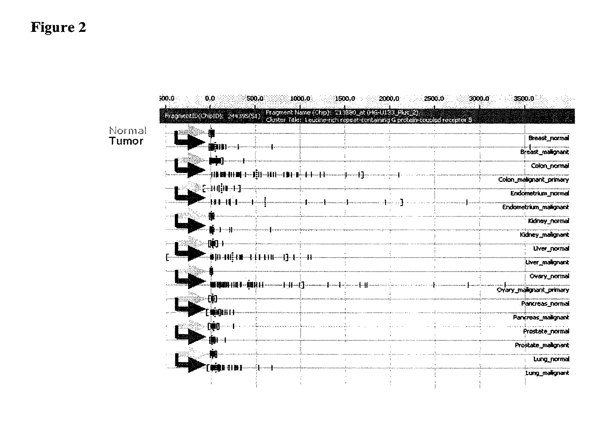 Compositions and methods for treating and diagnosing cancer