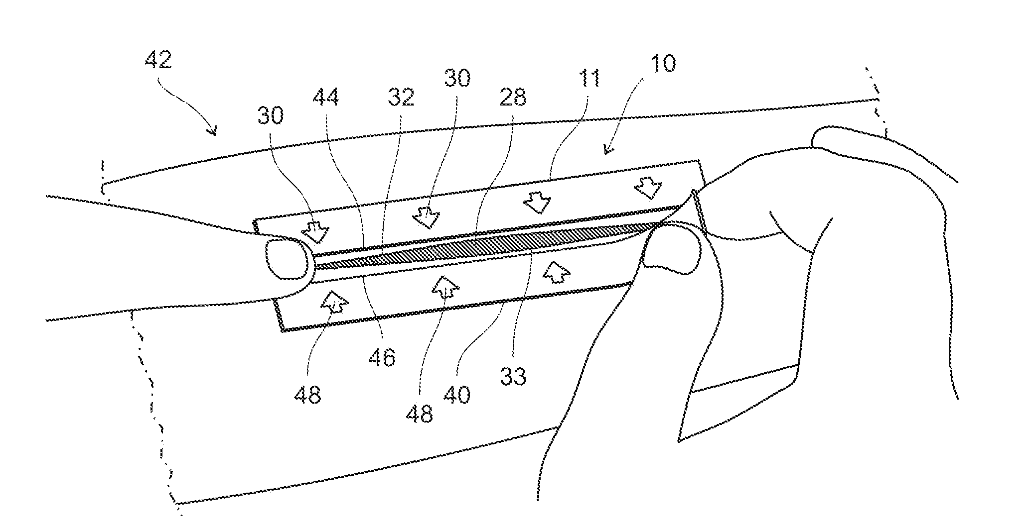 Magnetic Wound Closure Device and Method of Use