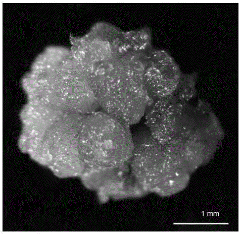 Tissue culture propagation method for obtaining cibotium barometz green globular body