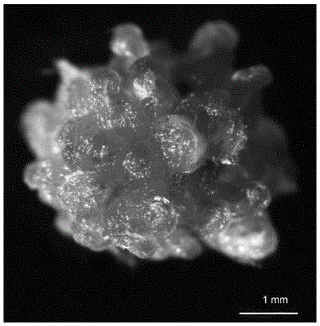 Tissue culture propagation method for obtaining cibotium barometz green globular body