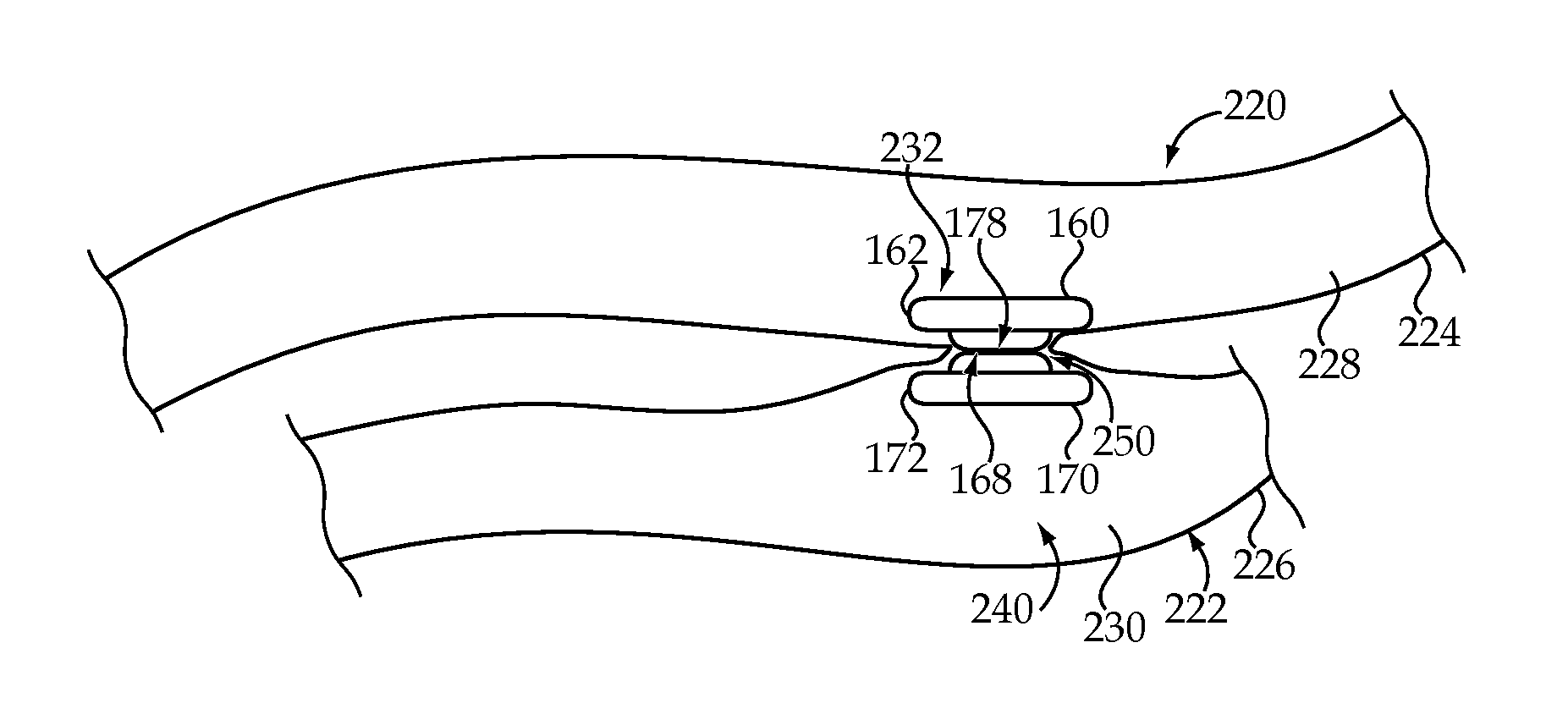 Endovascular delivery system for magnetic compression vascular anastomosis