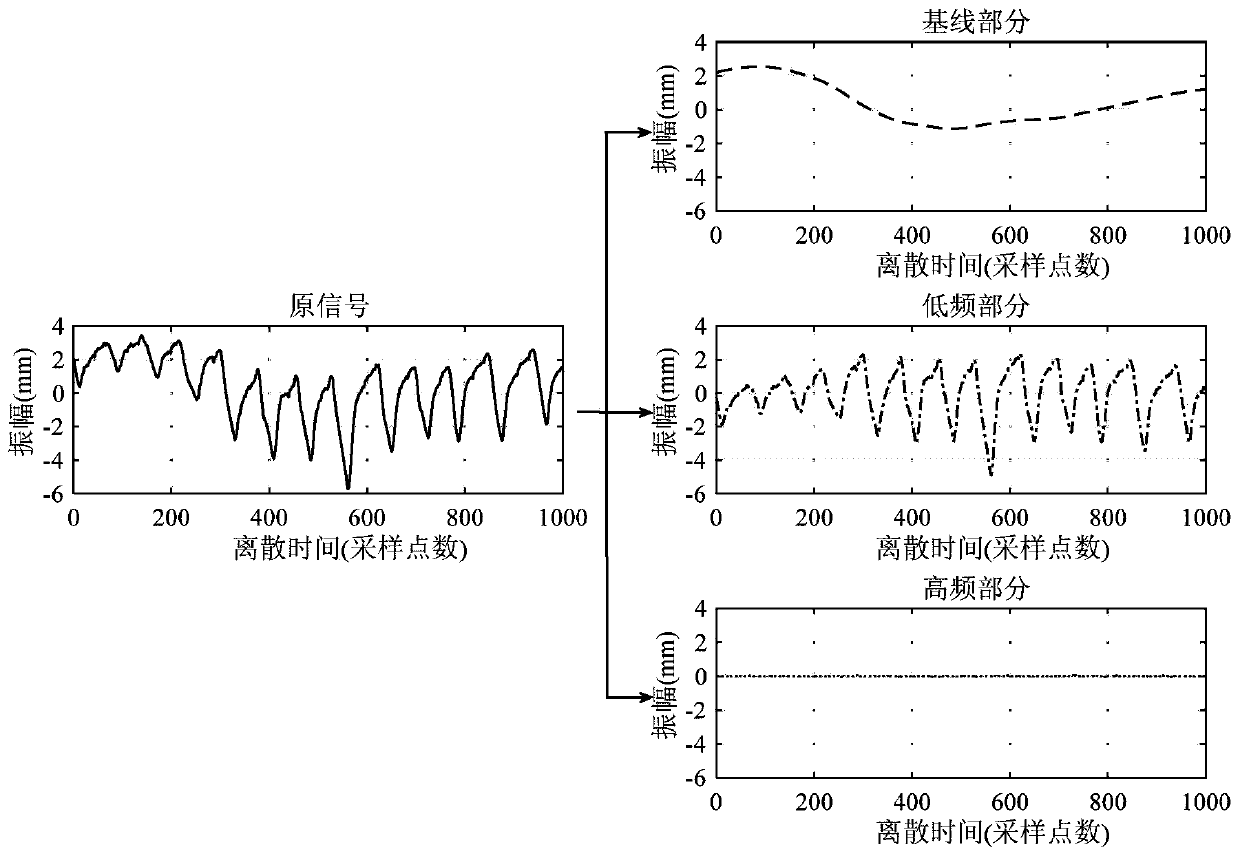 Patient chest-and-belly tumor breathing movement predicting and tracking method