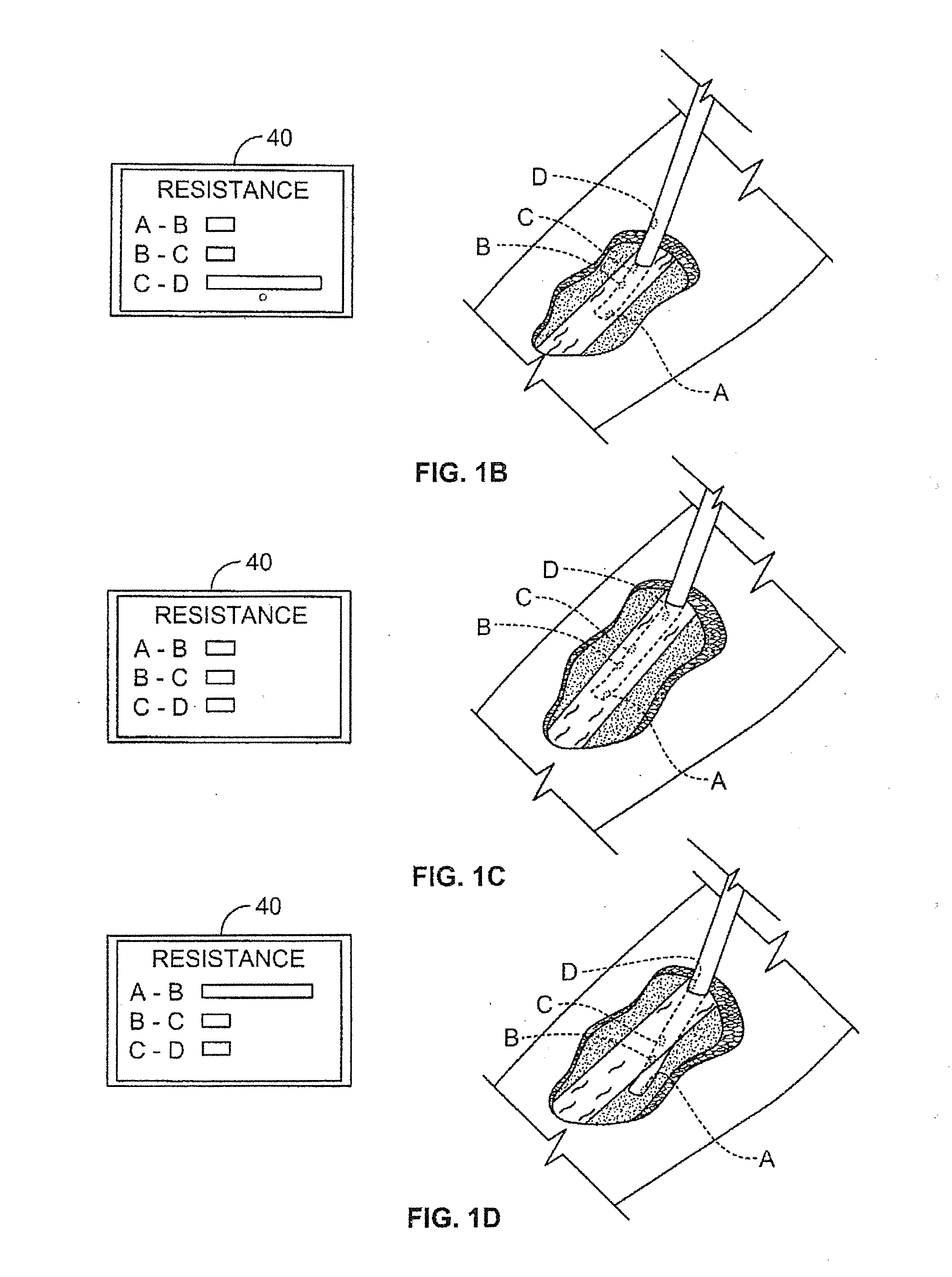 Intravenous apparatus and method