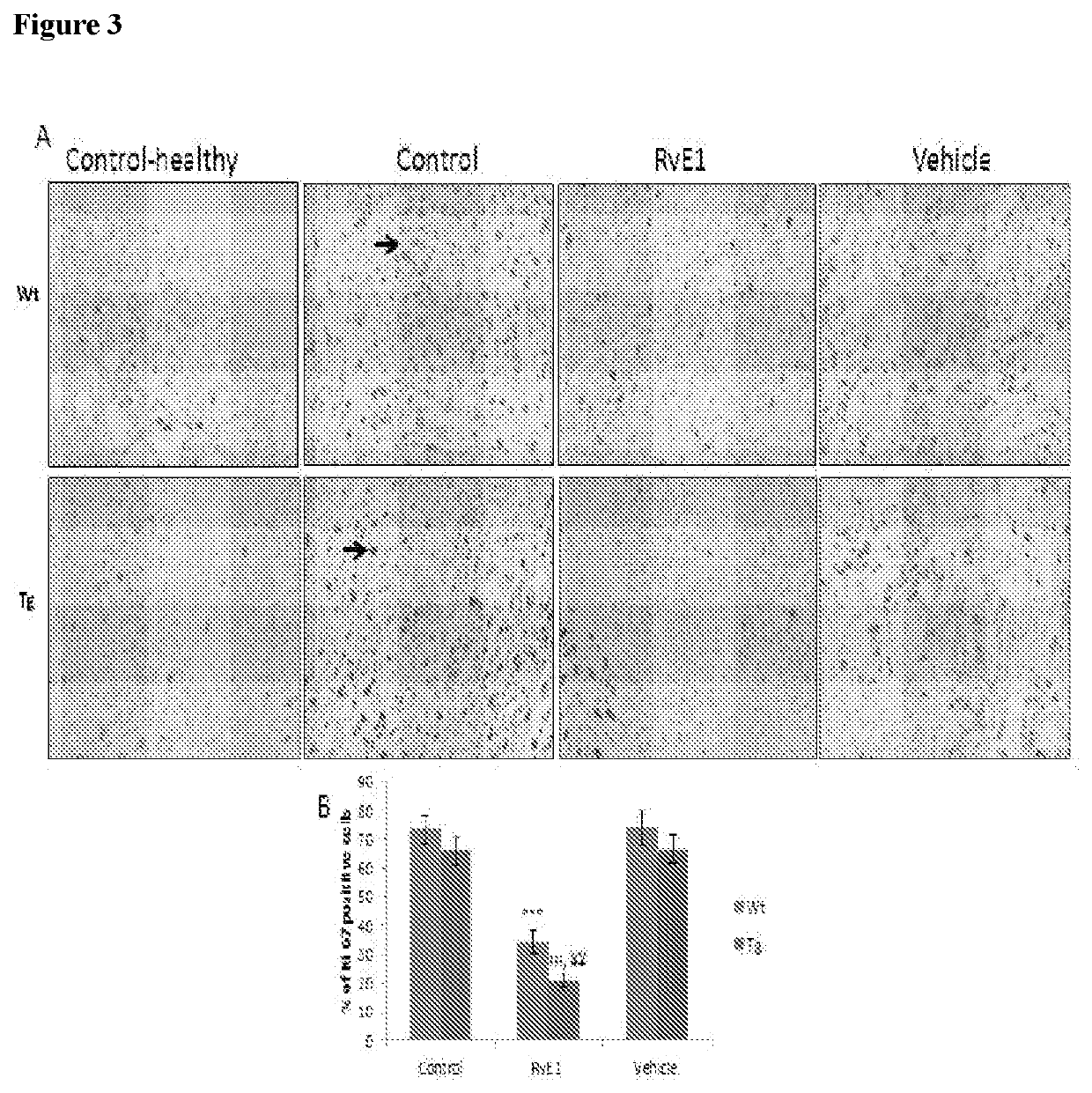 Compositions and methods of treating cancer using lipid agonists and receptors thereof