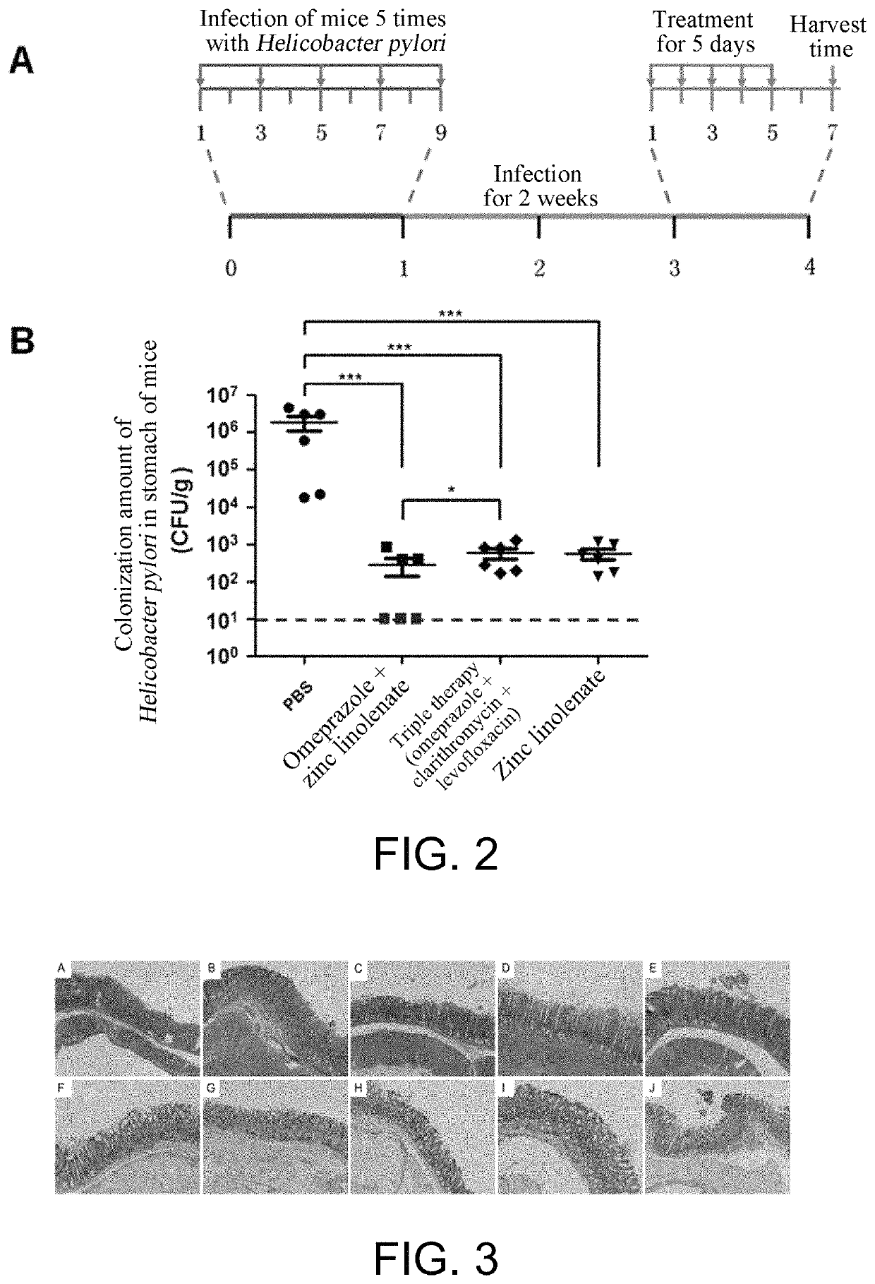 Preparation of zinc linolenate, and application of zinc linolenate in preparing anti-helicobacter pylori drug