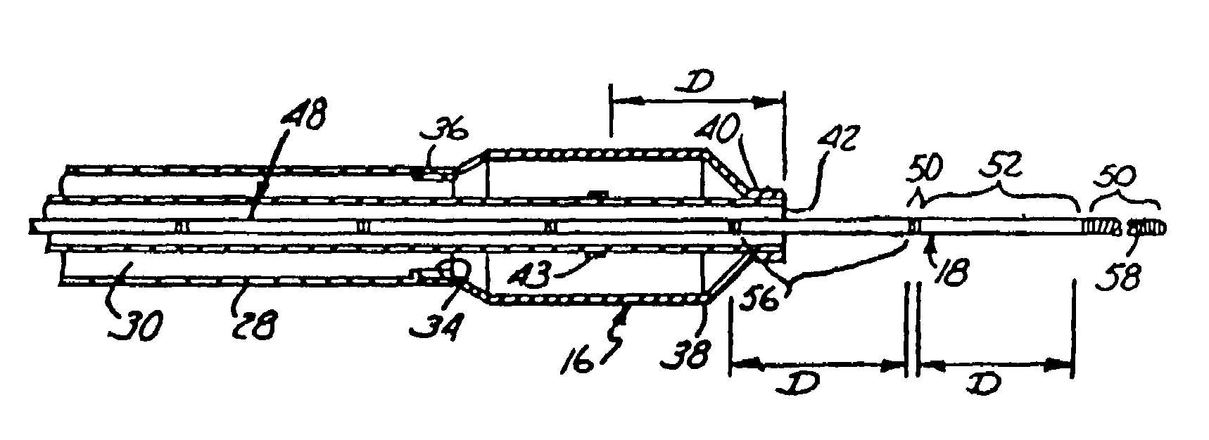 Guidewire with multiple radiopaque marker sections