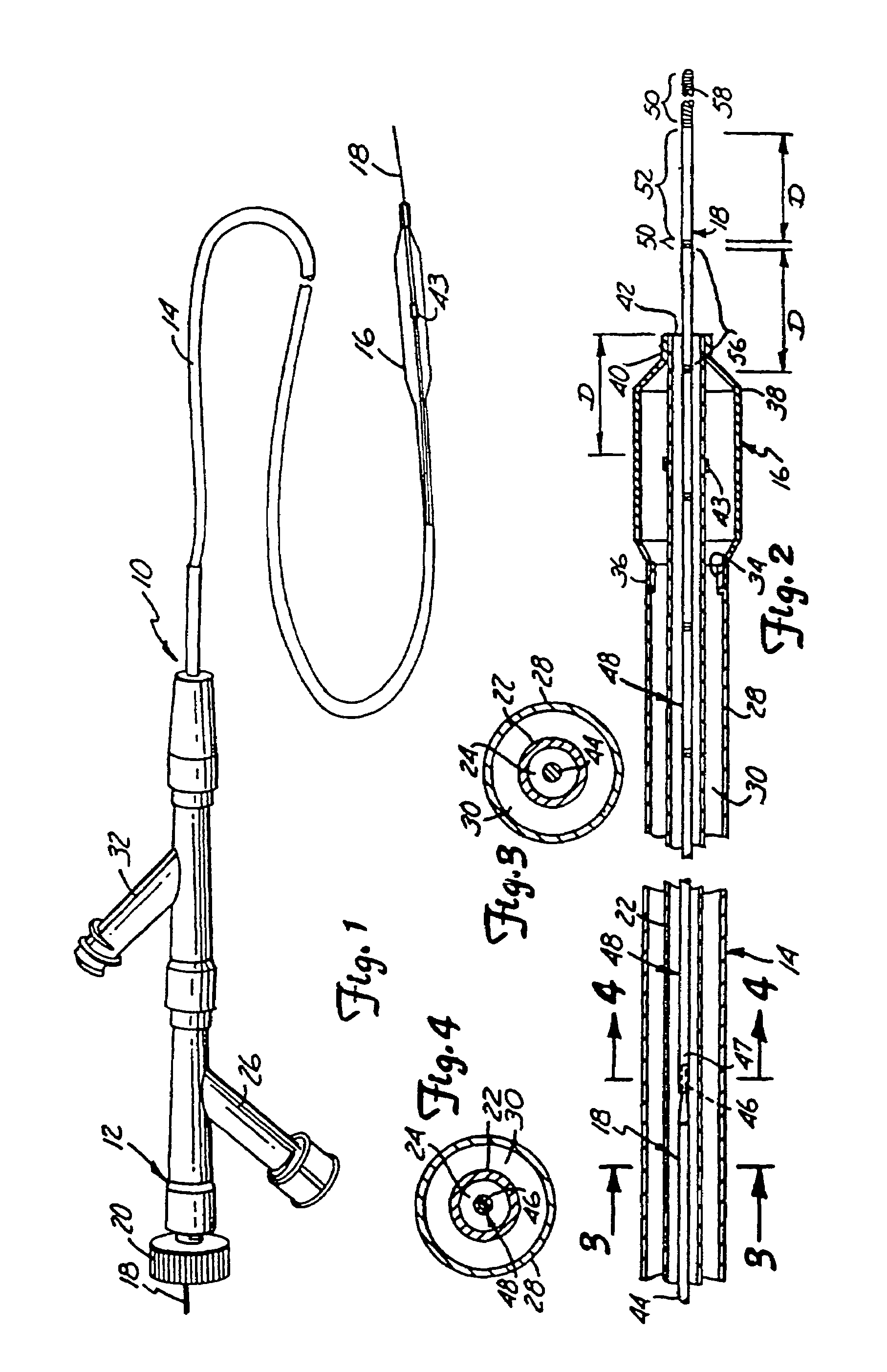 Guidewire with multiple radiopaque marker sections