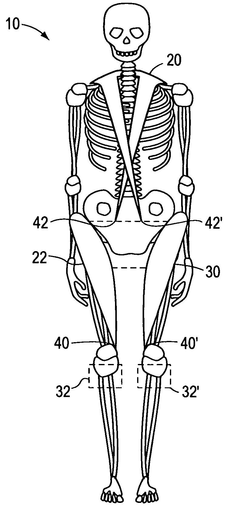 Resistance fitness suit