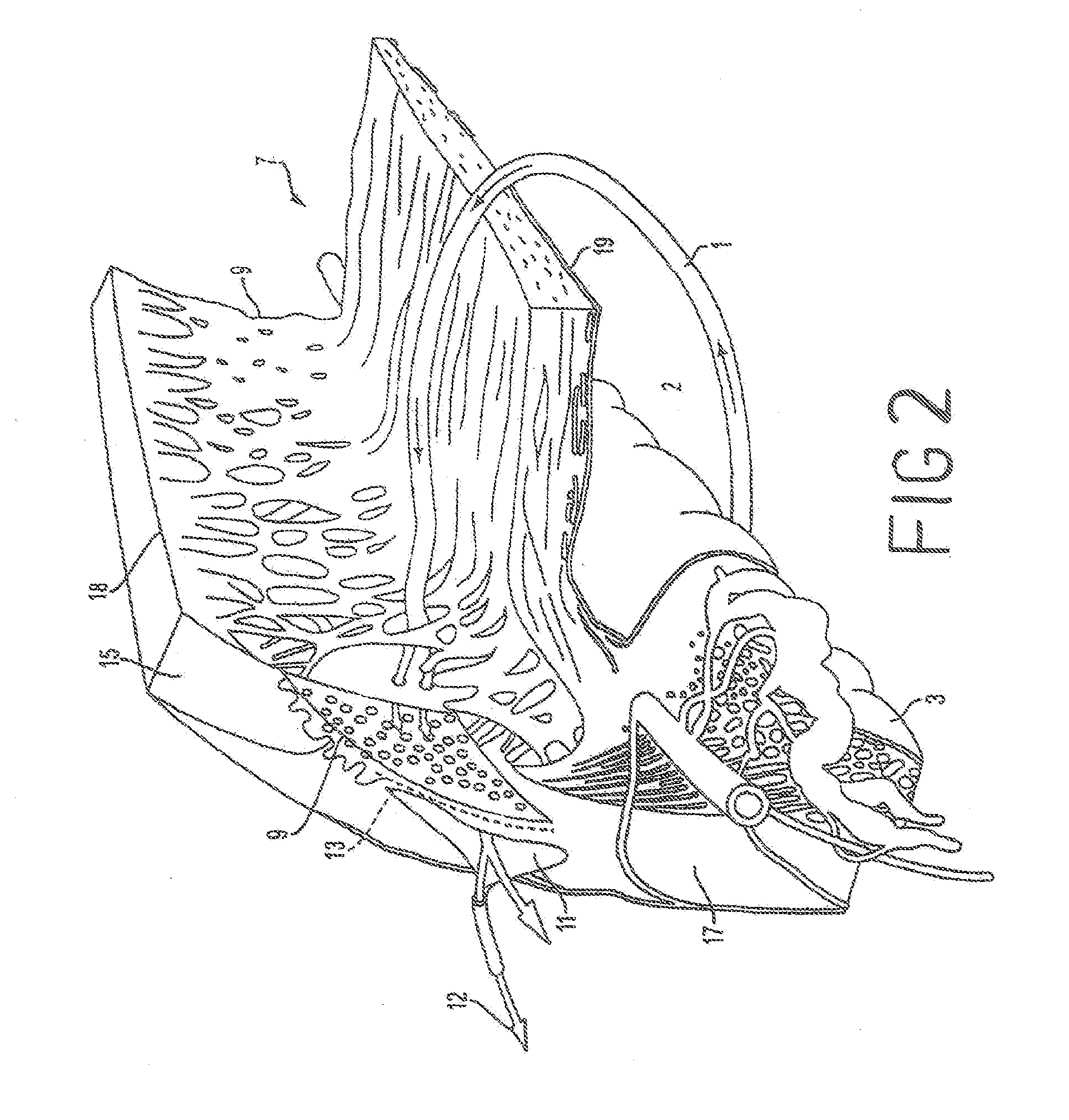 Methods and Apparatuses for the Treatment of Glaucoma using visible and infrared ultrashort laser pulses