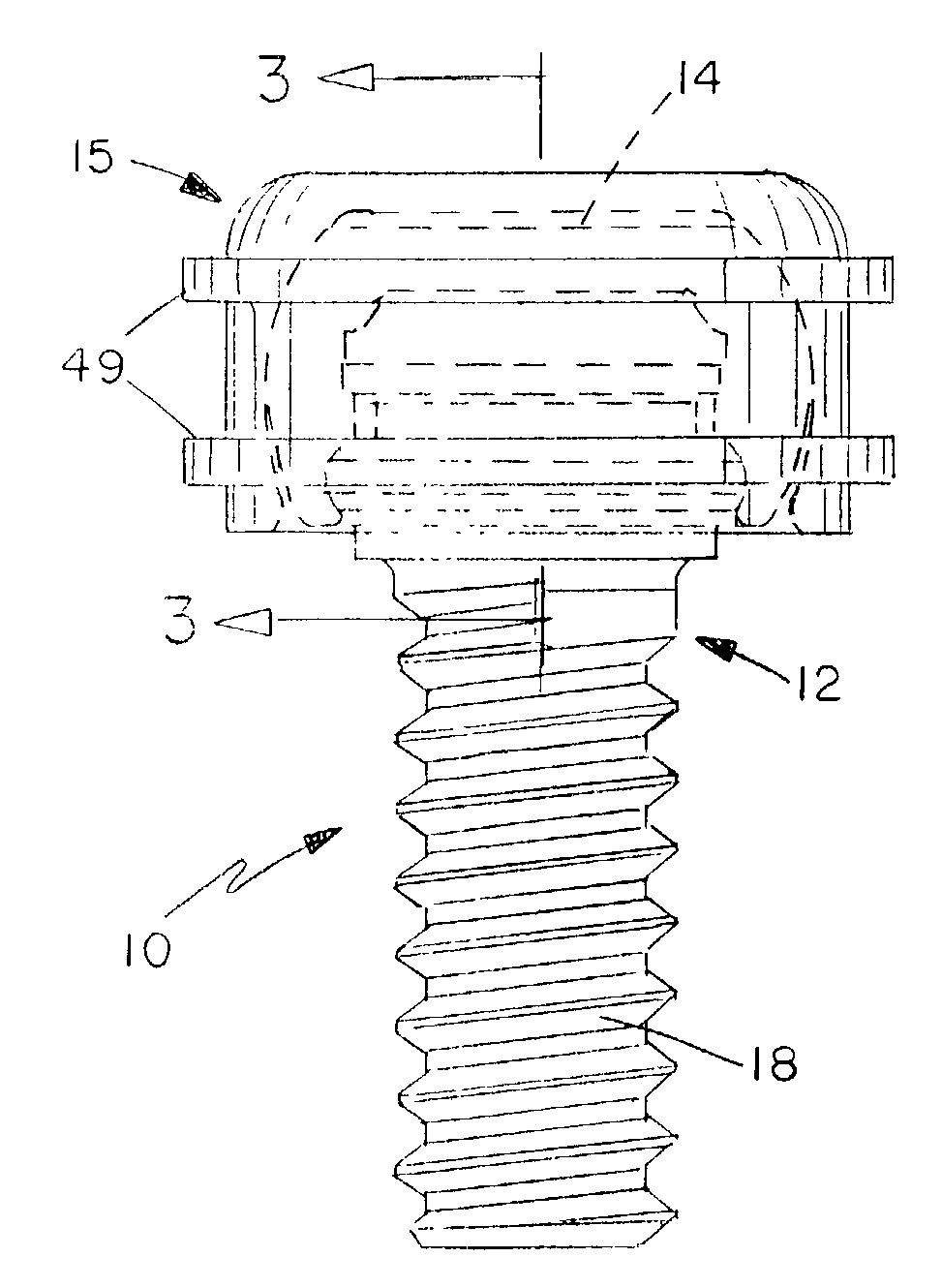 Dental attachment assembly and method