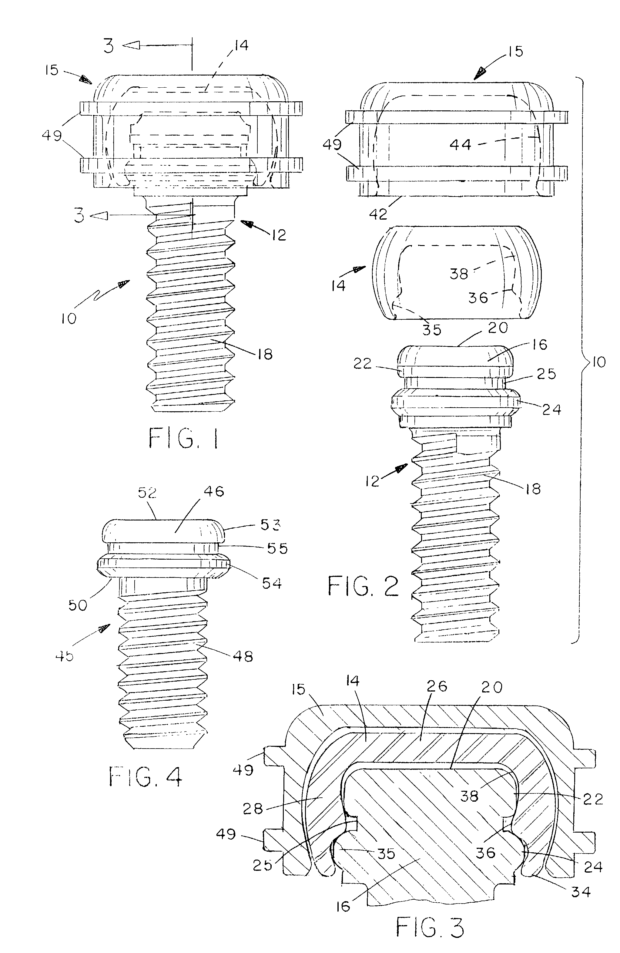 Dental attachment assembly and method