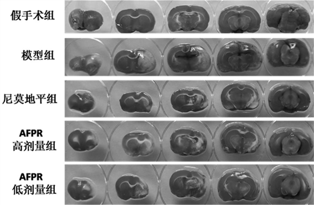 Application of polyrhachis vicina roger extract in preparation of anti-cerebral ischemia drugs